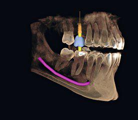 dentiste Pontault Combault imagerie dentaire
